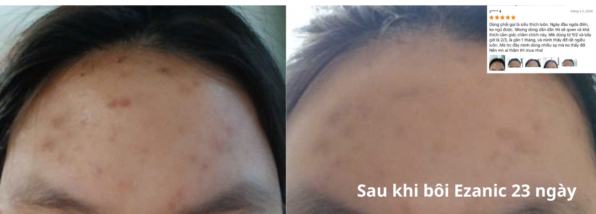 Đánh giá hiệu quả Ezanic sau 23 ngày